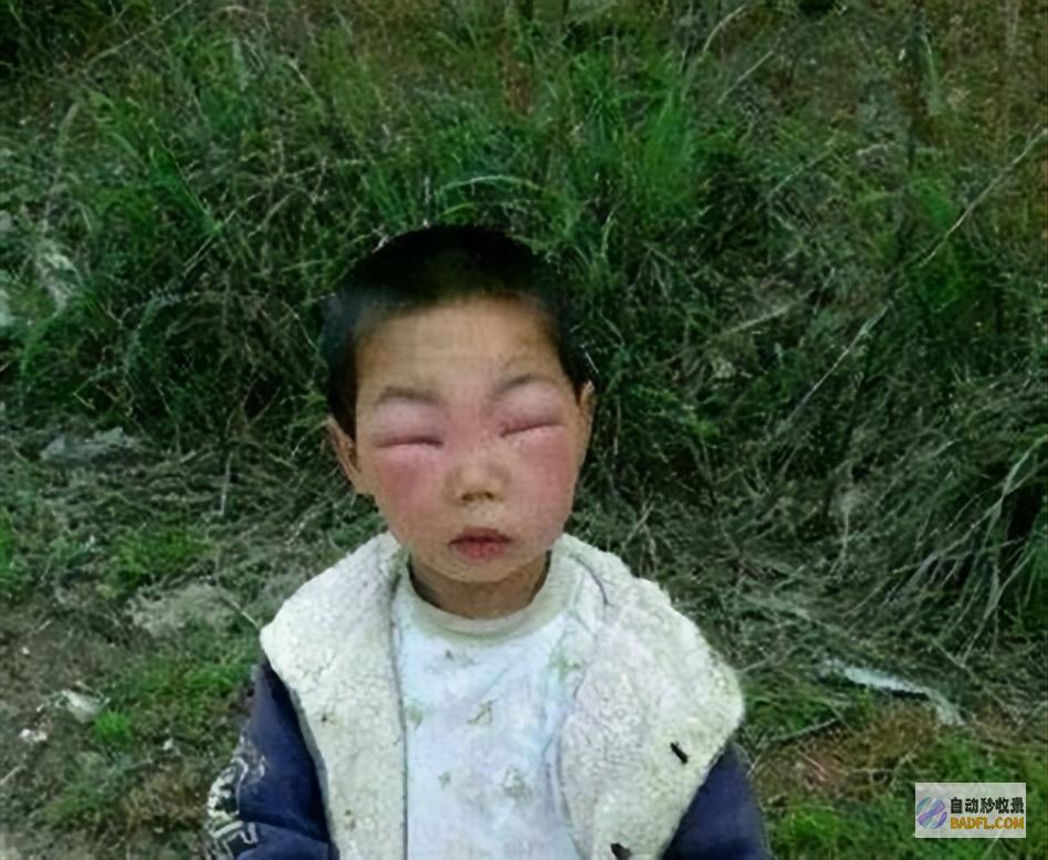 警觉那些咬人的毒虫隐形刺客出没最后一种的毒液