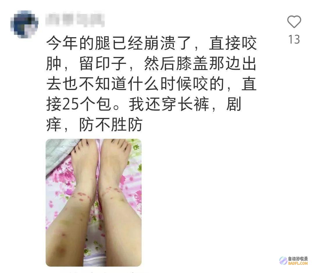 已到高发期也有人中招不少人晒出照片痒到解