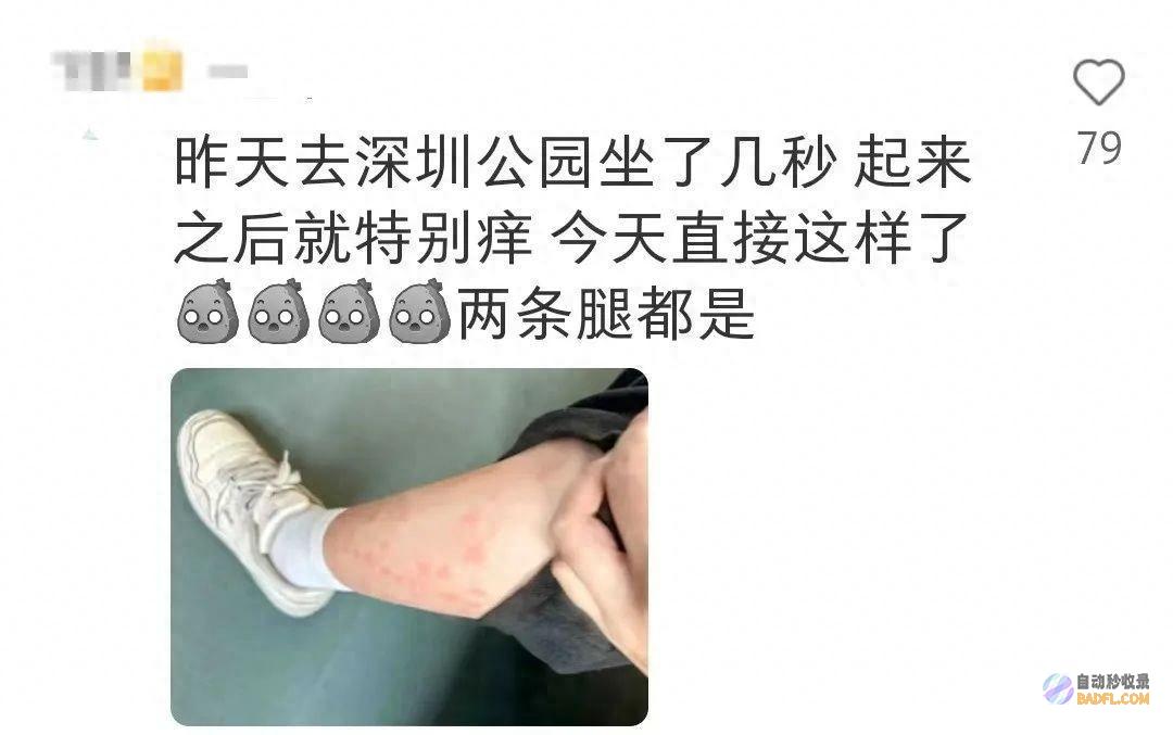 已到高发期！青岛也有人中招 不少人晒出照片 痒到解体…… (已到高发期尚无特效药)
