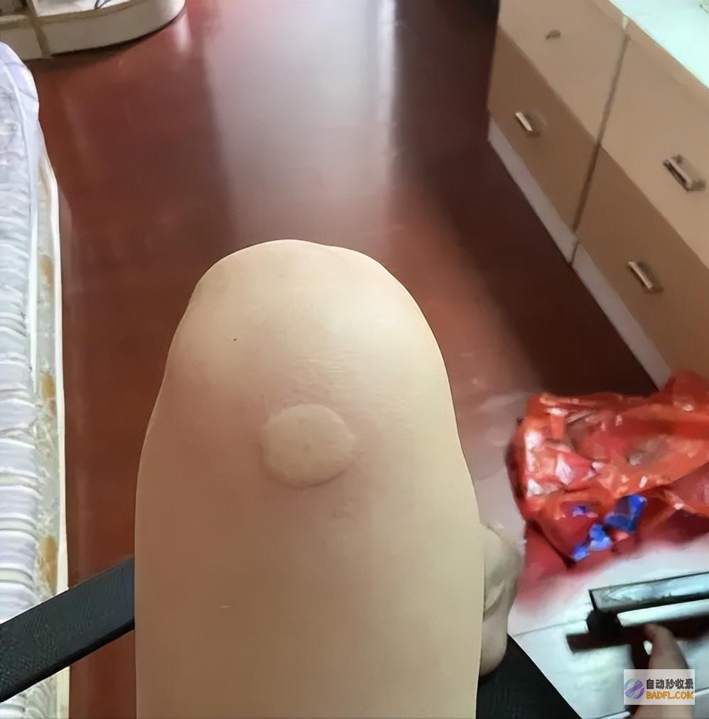 一群人里为啥偏偏就咬你?与血型有关真正的