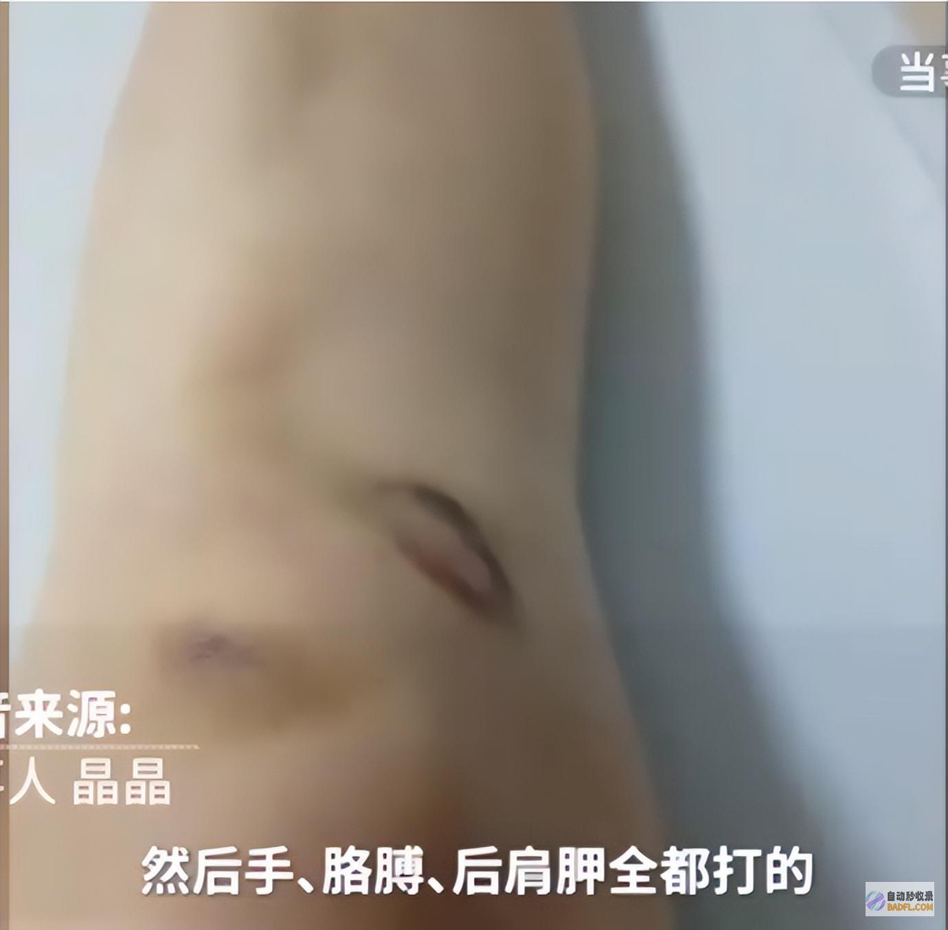 被害人多处受伤监督寓居时期杀害19岁堂妹令人气