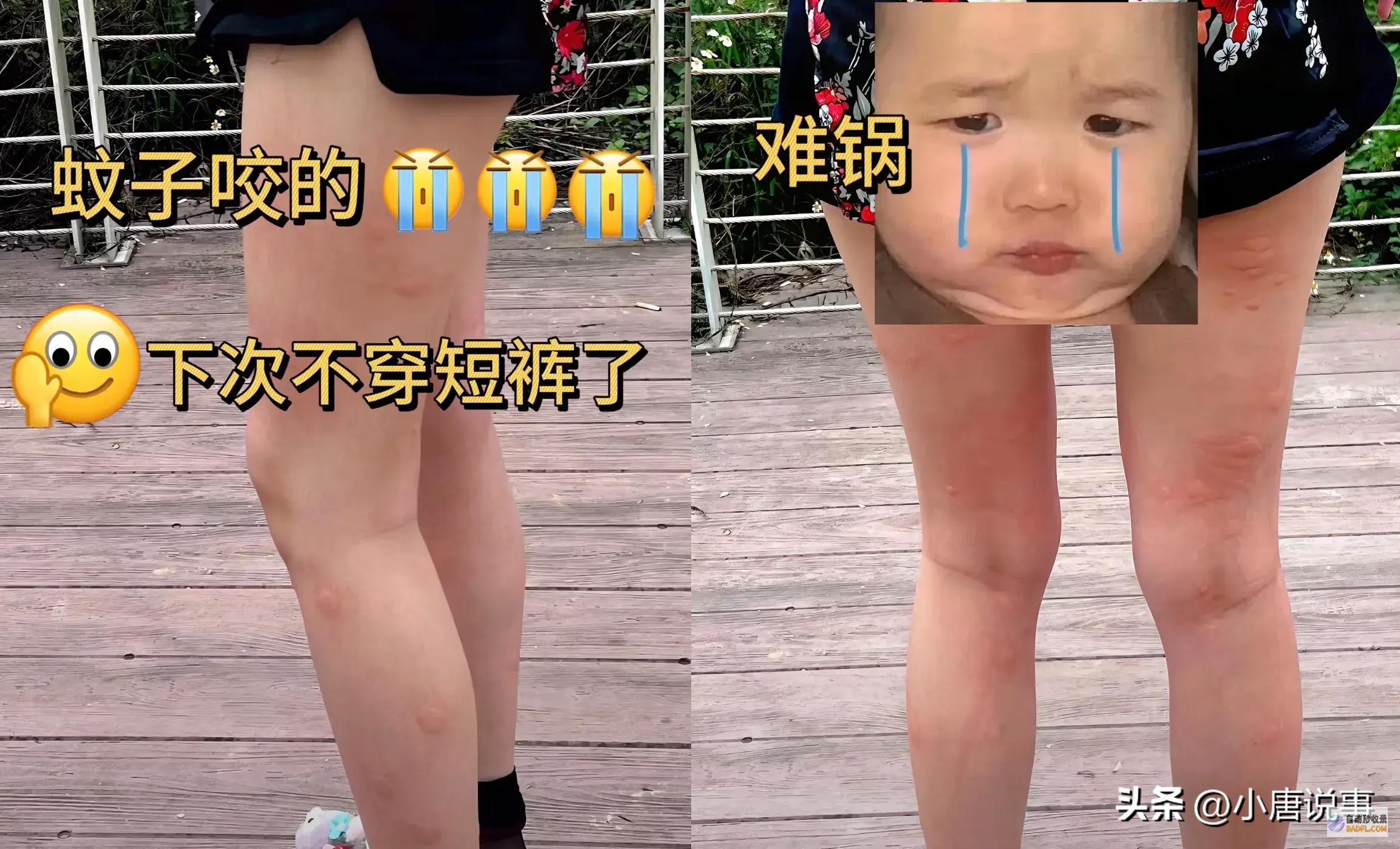 去过新疆旅行的人嘴是真严呐游客在阿勒泰饱受蚊