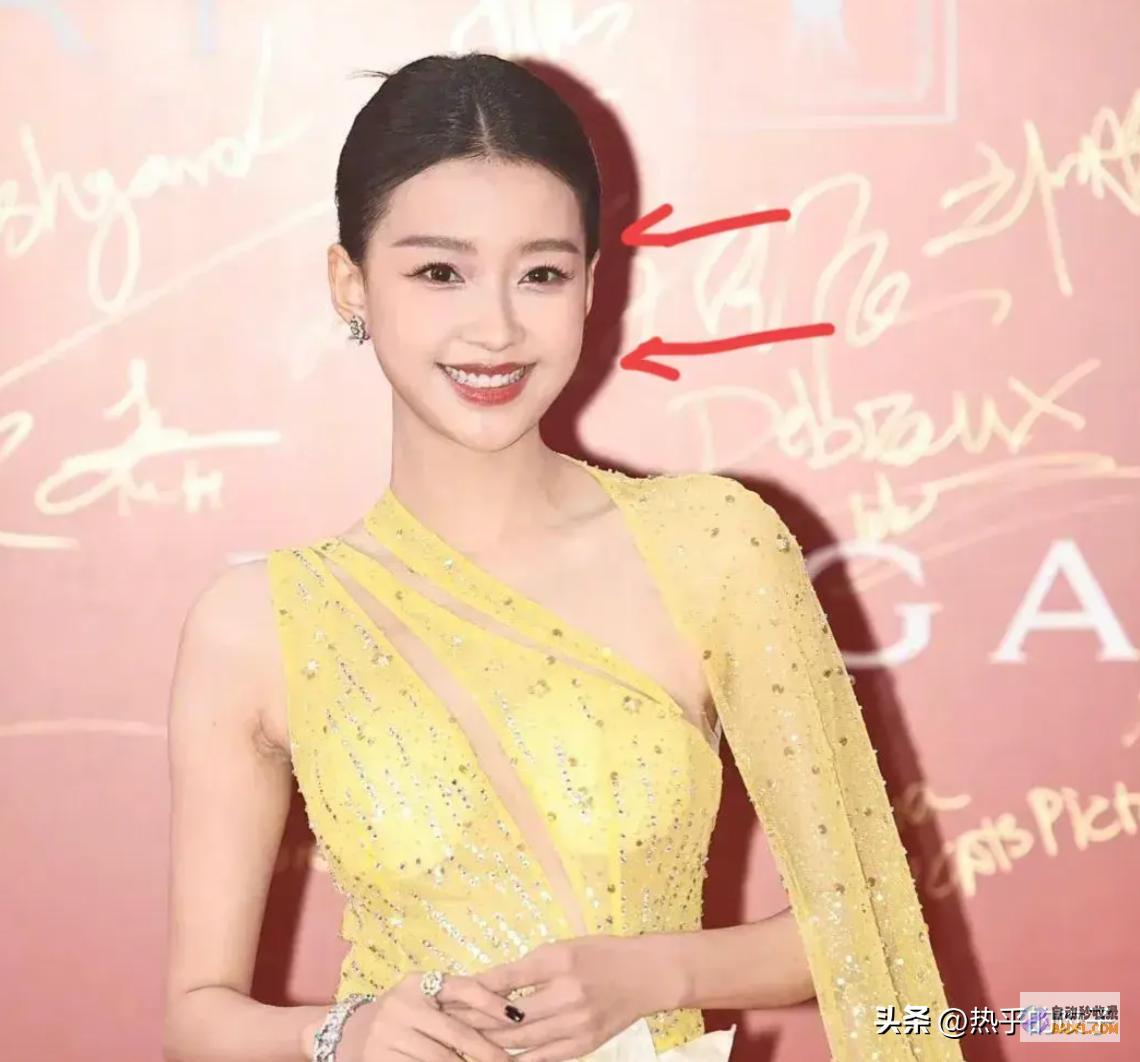 满脸皱纹的给一切医美脸的明星们上了一课上