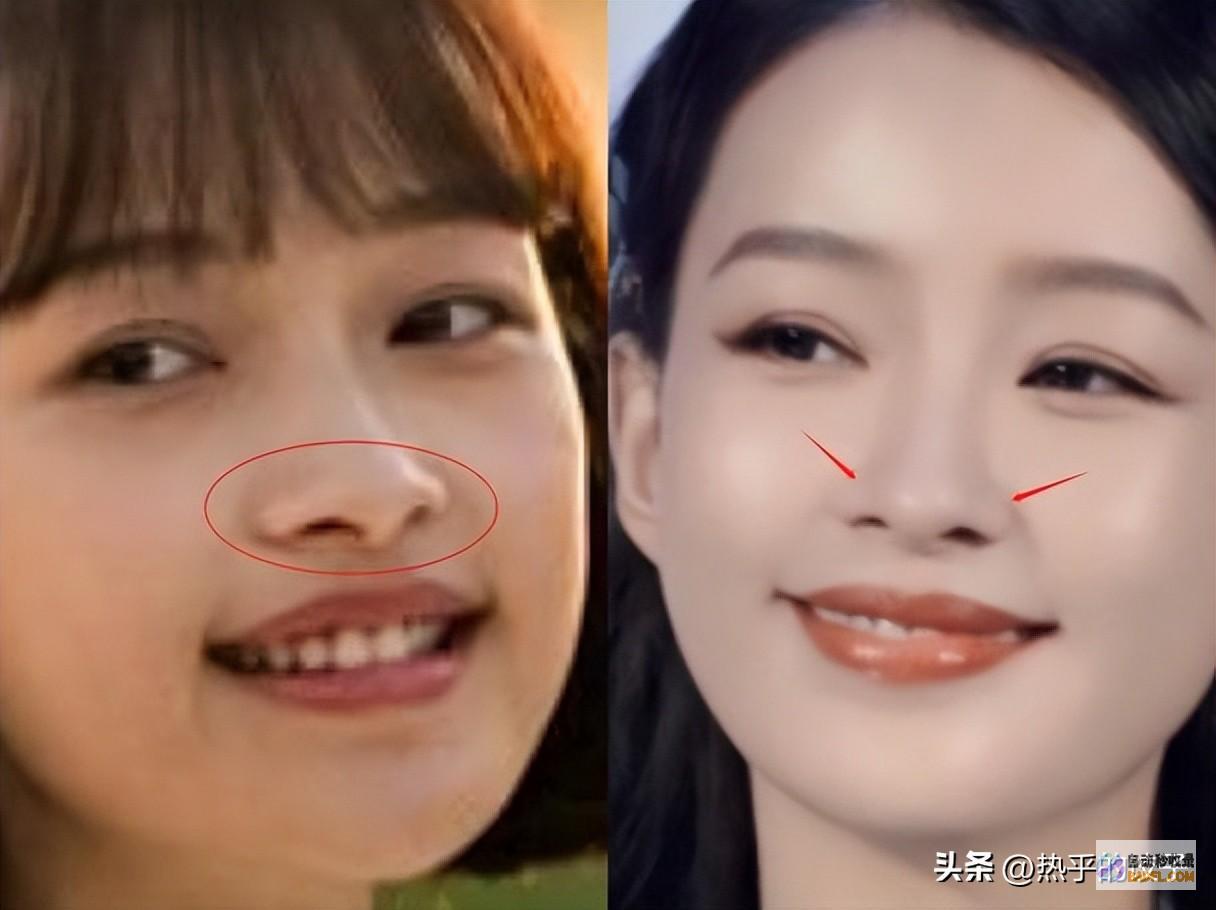 满脸皱纹的给一切医美脸的明星们上了一课上
