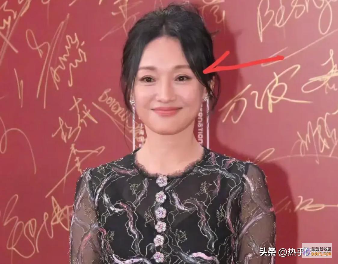 满脸皱纹的给一切医美脸的明星们上了一课上