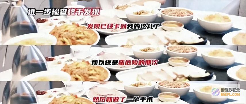 提示大家吃饭要小心惊险张杰被骨头卡住自愿做手