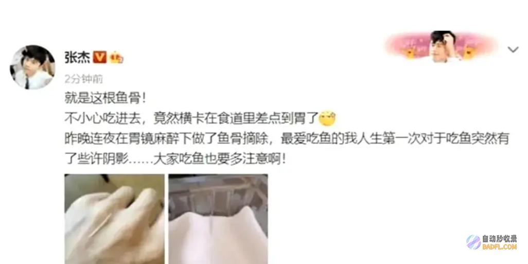 提示大家吃饭要小心惊险张杰被骨头卡住自愿做手