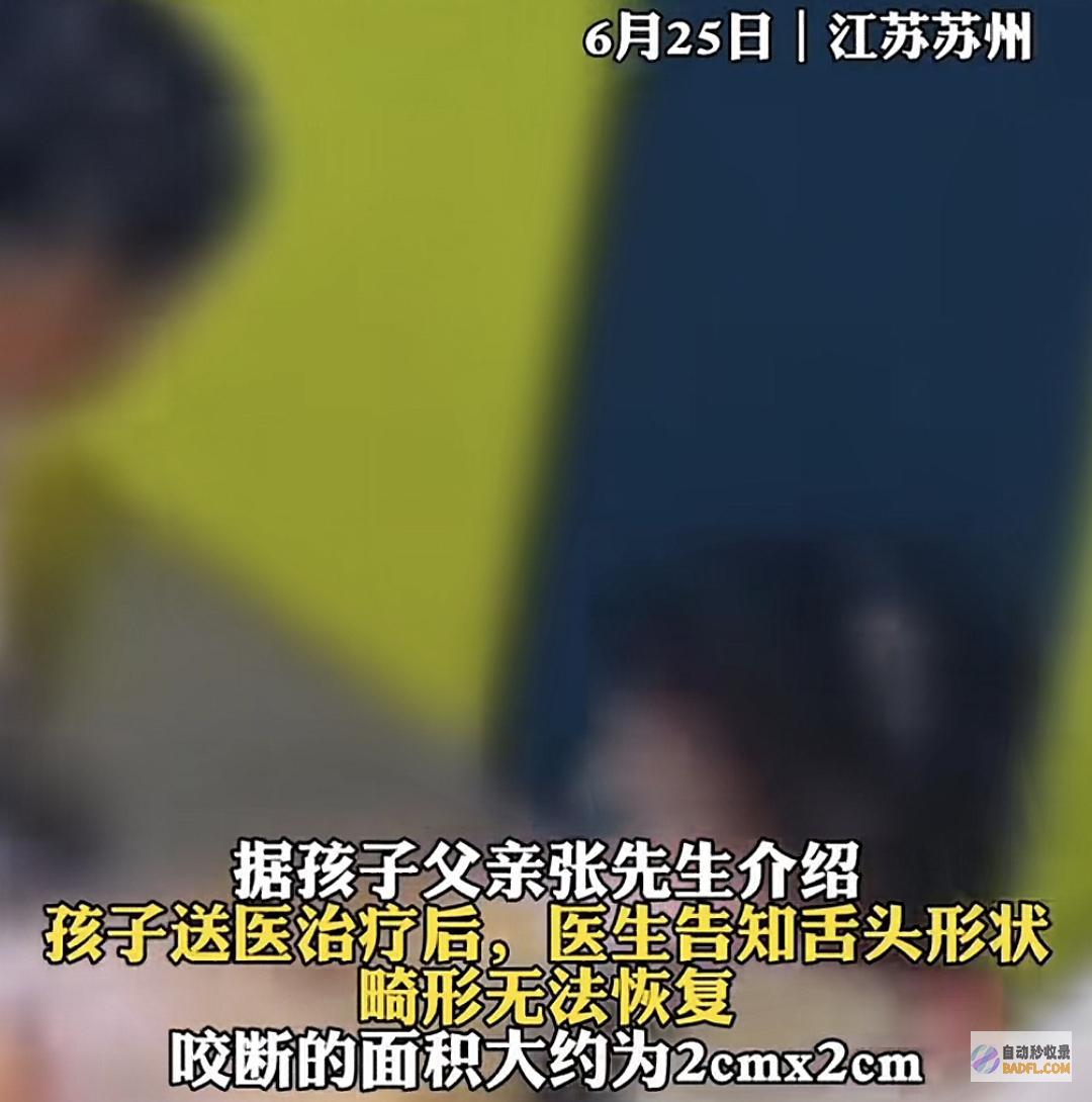 太心疼了3岁女童被同窗推搡咬断舌头学校和