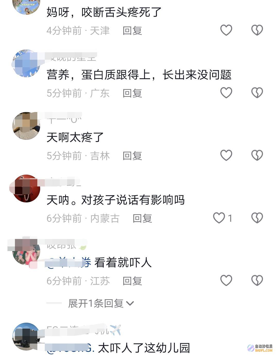 太心疼了3岁女童被同窗推搡咬断舌头学校和