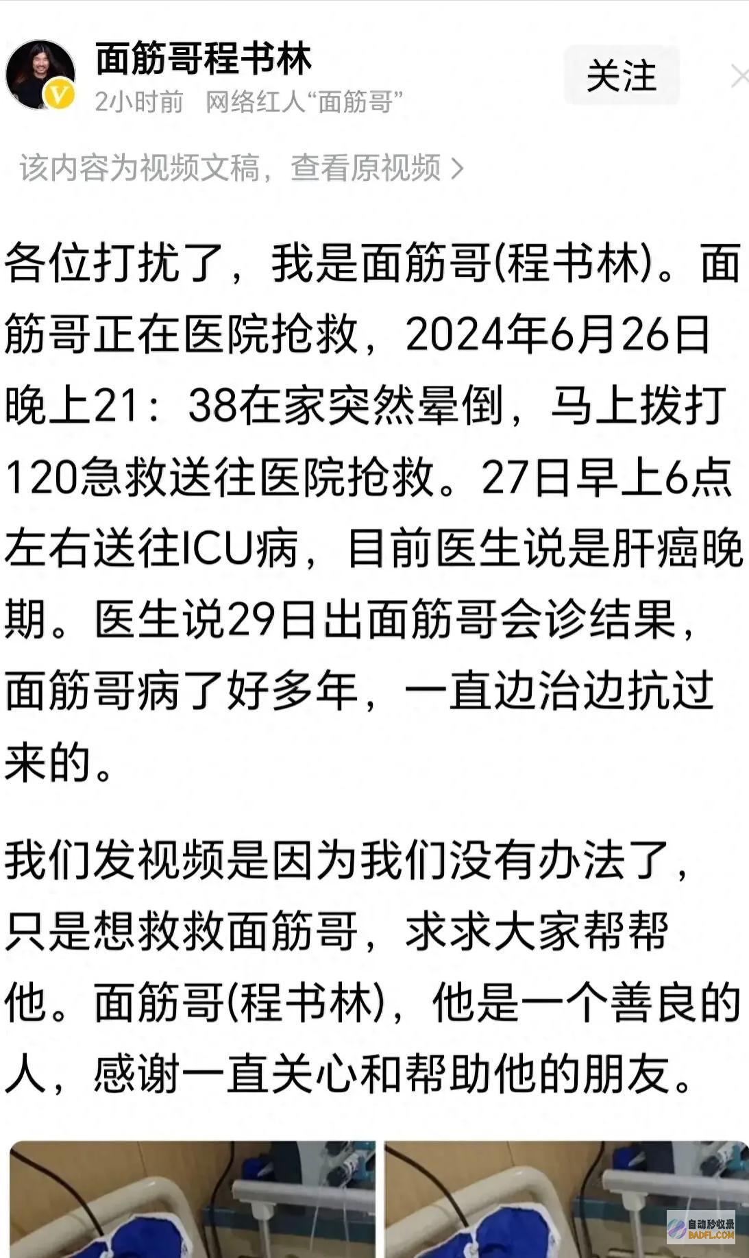 表情痛苦称没有了面筋哥肝癌病危发声求救抢