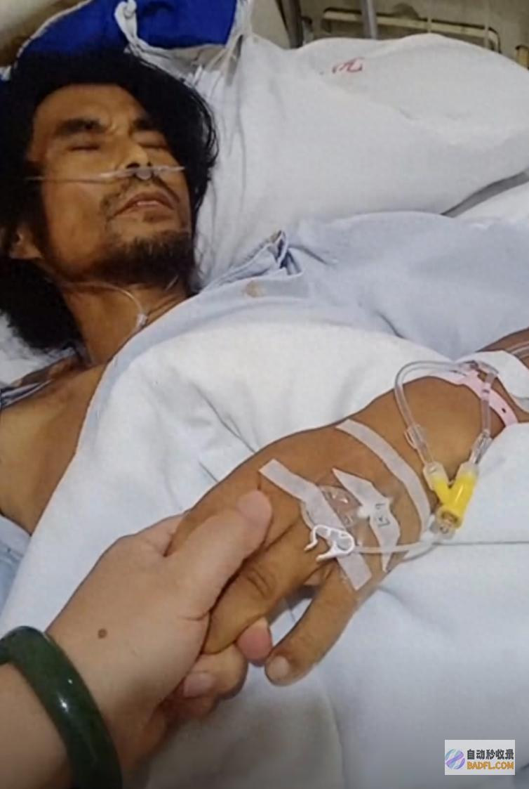 肝癌早期送ICU 须要200多万 网红 这几年的治疗费用都是我出的 女友发声 面筋哥 简直掏空了 (早期肝癌患者)