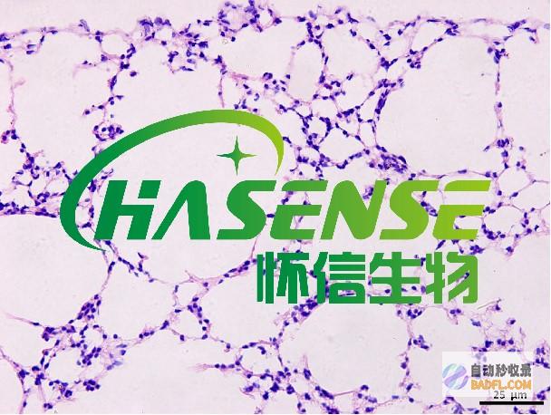 控制肺气肿的革命性偏方：改善肺功能，减轻症状 (控制肺气肿的药天天吃吗)