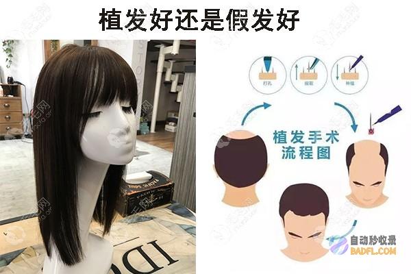 揭开脱发偏方的秘密：释放自然力量，重现头发生机 (脱发的偏方)