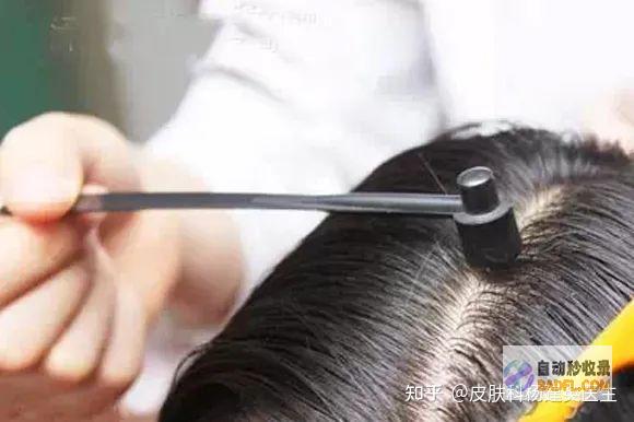 重获秀发