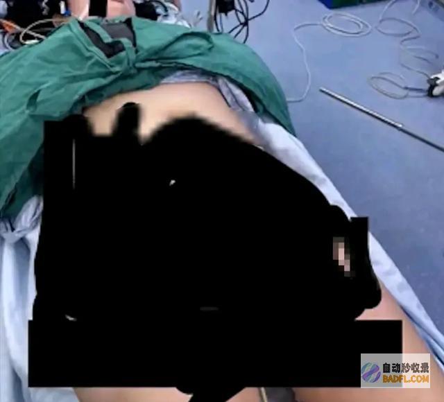 闹大了某医院手术女病人裸照被曝光网友我好