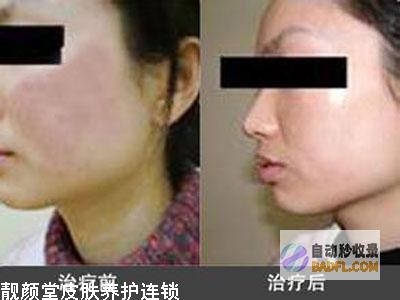 对药酒过敏者(对药酒过敏者怎么处理)