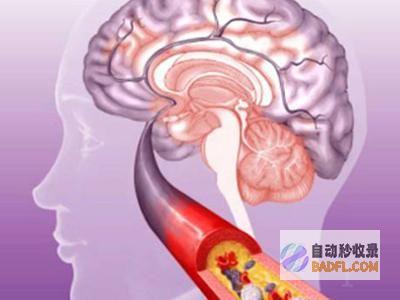 摆脱脑血栓：揭秘有效的偏方和预防措施 (已摆脱脑控)