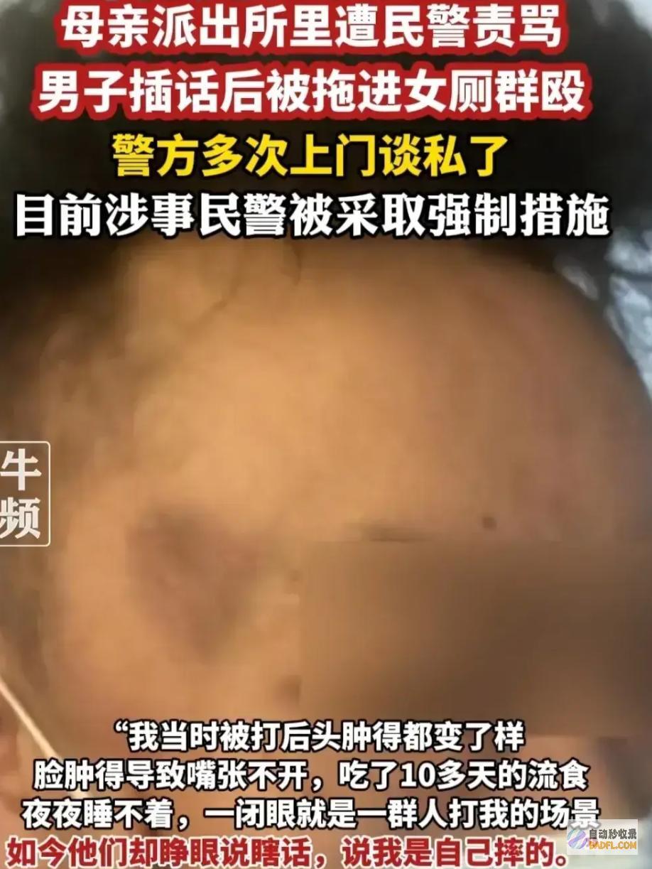 事大了从被殴打到被私了派出所暴力事情假相终于