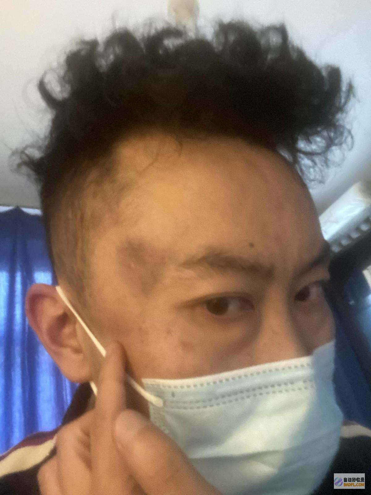 事大了从被殴打到被私了派出所暴力事情假相终于