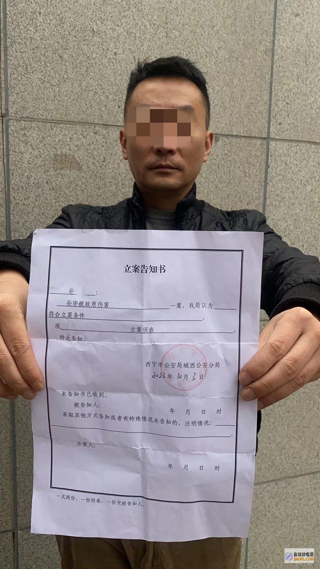 事大了从被殴打到被私了派出所暴力事情假相终于